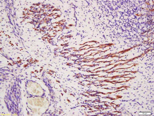 Immunohistochemistry (Formalin/PFA-fixed paraffin-embedded sections) - Anti-TXLNB antibody (AB203302)