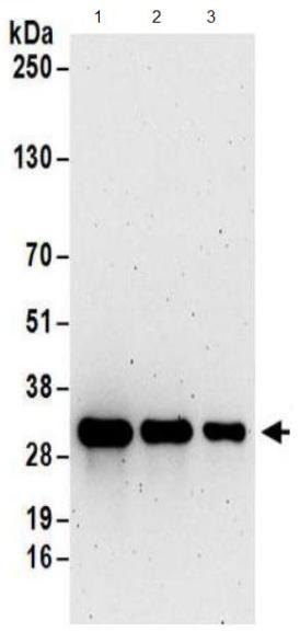 Western blot - Anti-TXNDC/TMX antibody (AB174660), expandable thumbnail