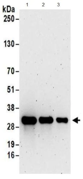 Western blot - Anti-TXNDC/TMX antibody (AB174660)