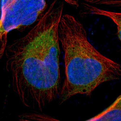 Immunocytochemistry/ Immunofluorescence - Anti-TXNDC/TMX antibody (AB244263), expandable thumbnail