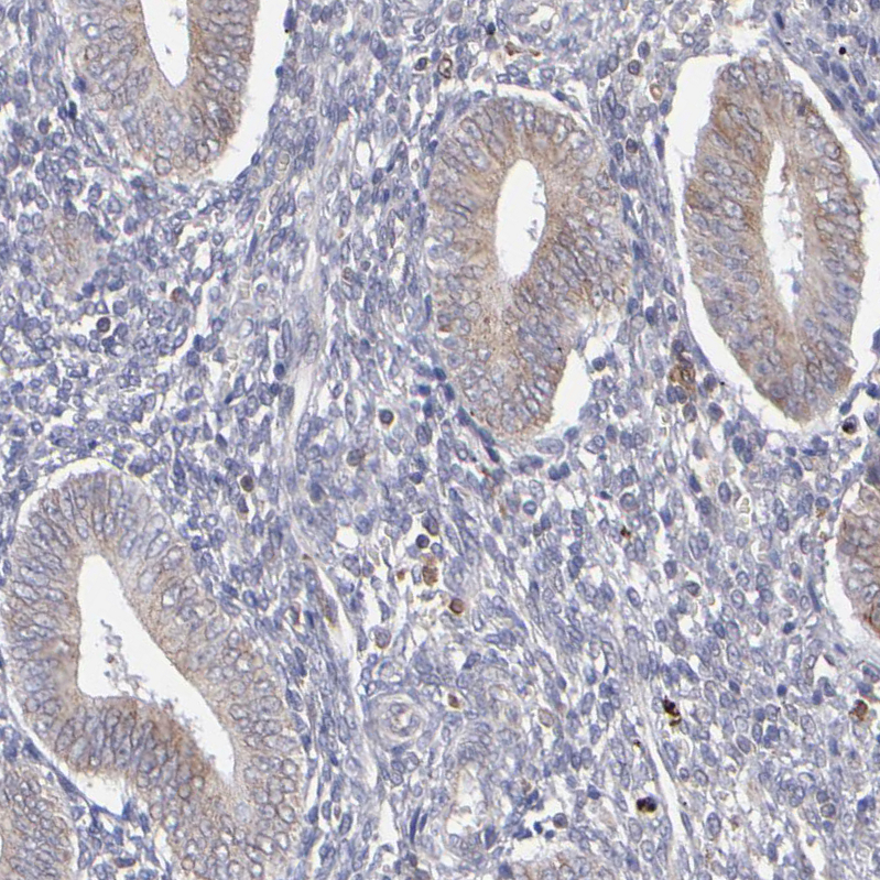 Immunohistochemistry (Formalin/PFA-fixed paraffin-embedded sections) - Anti-TXNDC/TMX antibody (AB244263), expandable thumbnail