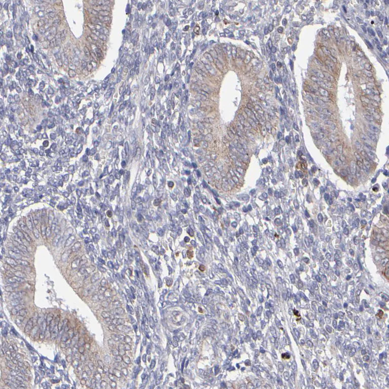 Immunohistochemistry (Formalin/PFA-fixed paraffin-embedded sections) - Anti-TXNDC/TMX antibody (AB244263)