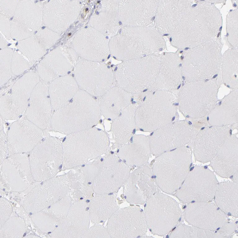 Immunohistochemistry (Formalin/PFA-fixed paraffin-embedded sections) - Anti-TXNDC/TMX antibody (AB244263)