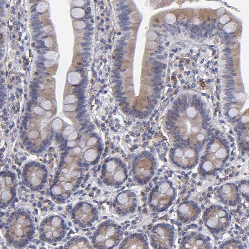 Immunohistochemistry (Formalin/PFA-fixed paraffin-embedded sections) - Anti-TXNDC/TMX antibody (AB244263), expandable thumbnail