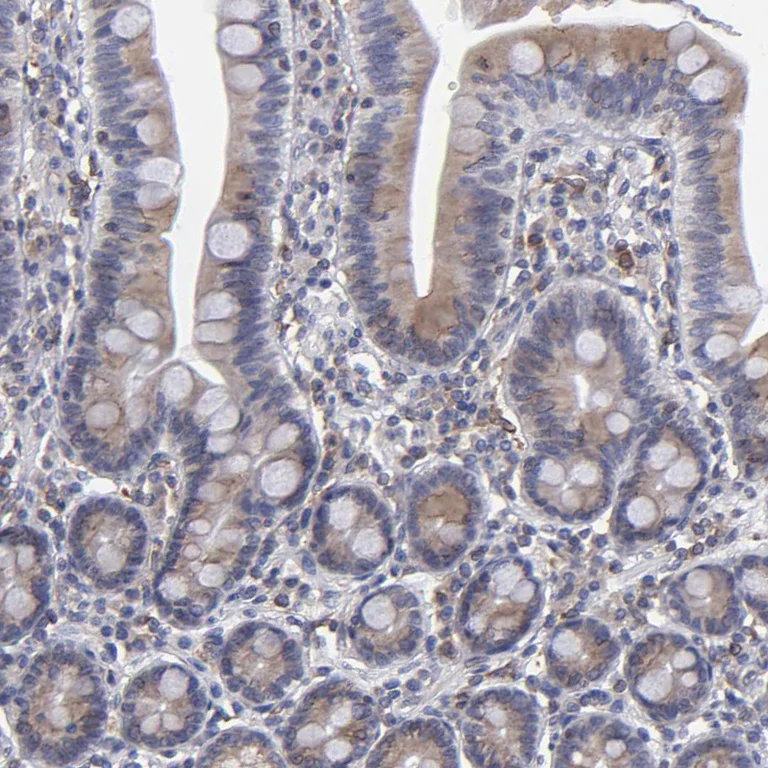 Immunohistochemistry (Formalin/PFA-fixed paraffin-embedded sections) - Anti-TXNDC/TMX antibody (AB244263)