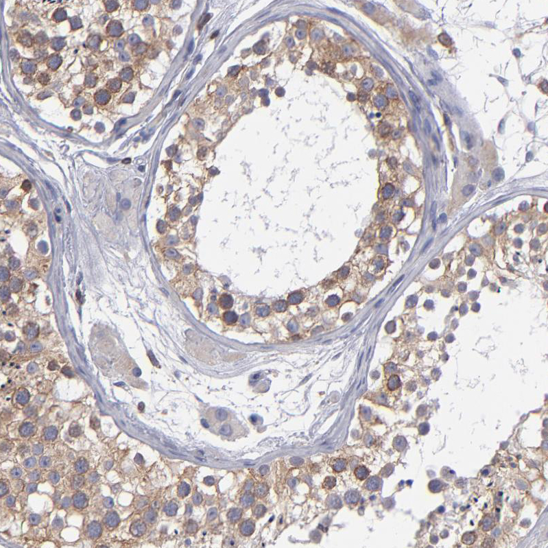 Immunohistochemistry (Formalin/PFA-fixed paraffin-embedded sections) - Anti-TXNDC/TMX antibody (AB244263), expandable thumbnail