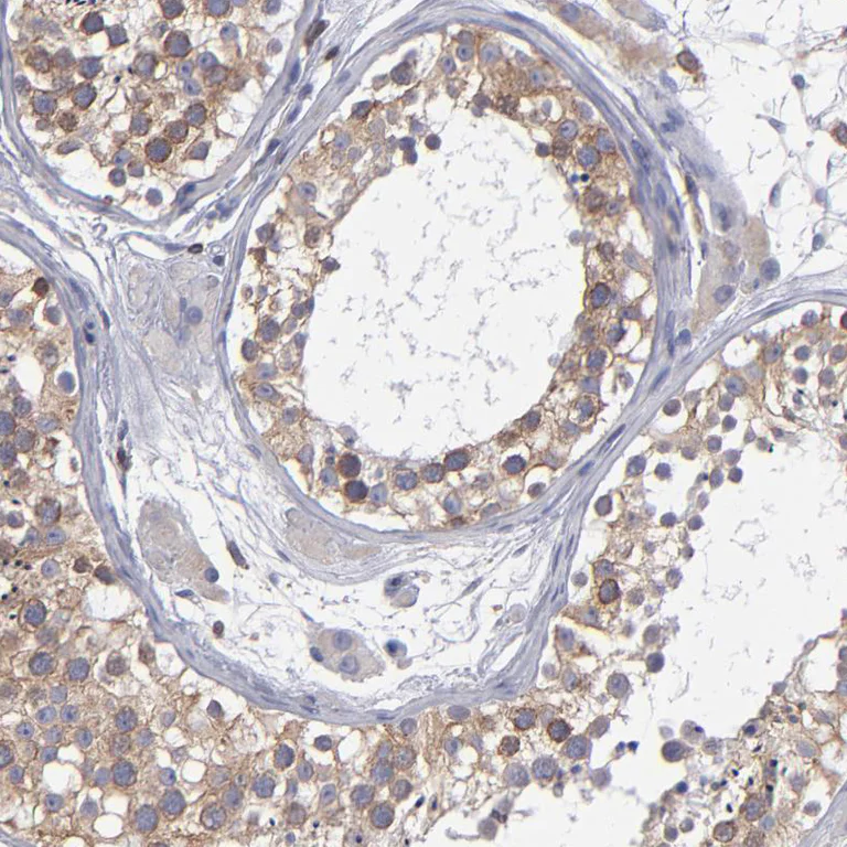 Immunohistochemistry (Formalin/PFA-fixed paraffin-embedded sections) - Anti-TXNDC/TMX antibody (AB244263)