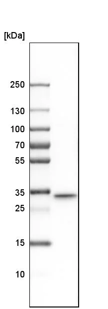 Western blot - Anti-TXNDC/TMX antibody (AB244263)