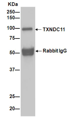 Immunoprecipitation - Anti-TXNDC11/EFP1 antibody [EPR14314] - C-terminal (AB188329)