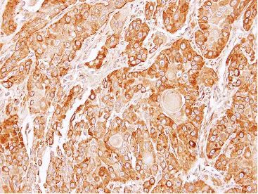 Immunohistochemistry (Formalin/PFA-fixed paraffin-embedded sections) - Anti-TXNDC4 antibody (AB137611)