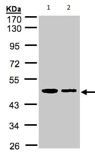 Western blot - Anti-TXNDC4 antibody (AB137611)