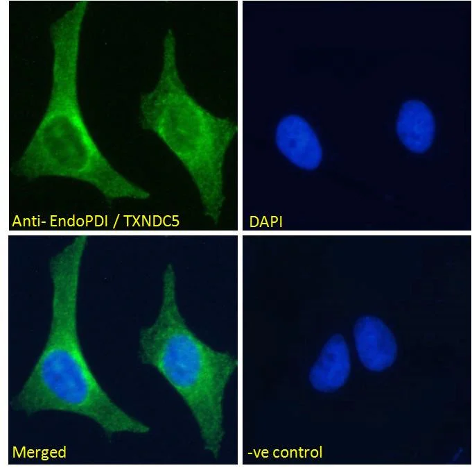 Immunocytochemistry/ Immunofluorescence - Anti-TXNDC5 antibody (AB13820)