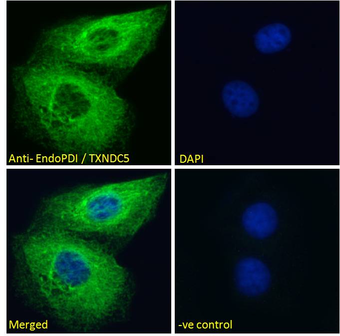 Immunocytochemistry/ Immunofluorescence - Anti-TXNDC5 antibody (AB13820)