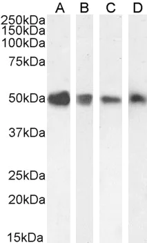 Western blot - Anti-TXNDC5 antibody (AB13820)