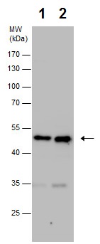 Western blot - Anti-TXNDC5 antibody (AB227623)