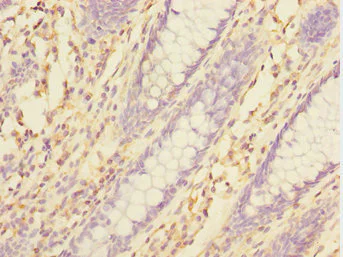 Immunohistochemistry (Formalin/PFA-fixed paraffin-embedded sections) - Anti-TXNDC5 antibody (AB237697)