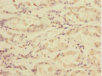 Immunohistochemistry (Formalin/PFA-fixed paraffin-embedded sections) - Anti-TXNDC5 antibody (AB237697)