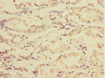 Immunohistochemistry (Formalin/PFA-fixed paraffin-embedded sections) - Anti-TXNDC5 antibody (AB237697)