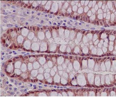 Immunohistochemistry (Formalin/PFA-fixed paraffin-embedded sections) - Anti-TXNDC9 antibody [EPR15238] (AB185959), expandable thumbnail