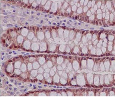 Immunohistochemistry (Formalin/PFA-fixed paraffin-embedded sections) - Anti-TXNDC9 antibody [EPR15238] (AB185959)