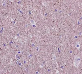 Immunohistochemistry (Formalin/PFA-fixed paraffin-embedded sections) - Anti-TXNDC9 antibody [EPR15238] (AB185959)