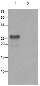 Immunoprecipitation - Anti-TXNDC9 antibody [EPR15238] (AB185959), expandable thumbnail