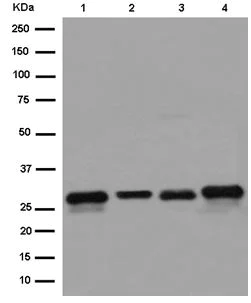 Western blot - Anti-TXNDC9 antibody [EPR15238] (AB185959)