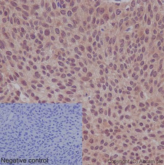 Immunohistochemistry (Formalin/PFA-fixed paraffin-embedded sections) - Anti-TXNDC9 antibody [EPR15239] (AB191405), expandable thumbnail