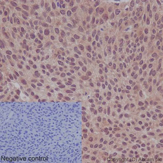 Immunohistochemistry (Formalin/PFA-fixed paraffin-embedded sections) - Anti-TXNDC9 antibody [EPR15239] (AB191405)
