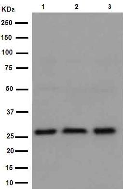 Western blot - Anti-TXNDC9 antibody [EPR15239] (ab191405), expandable thumbnail