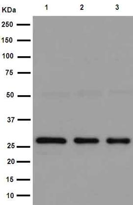 Western blot - Anti-TXNDC9 antibody [EPR15239] (AB191405), expandable thumbnail