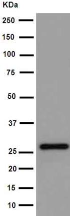 Western blot - Anti-TXNDC9 antibody [EPR15239] (AB191405), expandable thumbnail