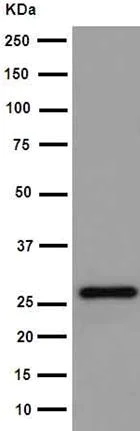 Western blot - Anti-TXNDC9 antibody [EPR15239] (AB191405)