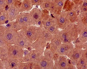 Immunohistochemistry (Formalin/PFA-fixed paraffin-embedded sections) - Anti-TXNIP antibody [EPR14774] (AB188865)