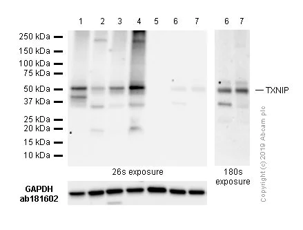 Western blot - Anti-TXNIP antibody [EPR14774] (AB188865)