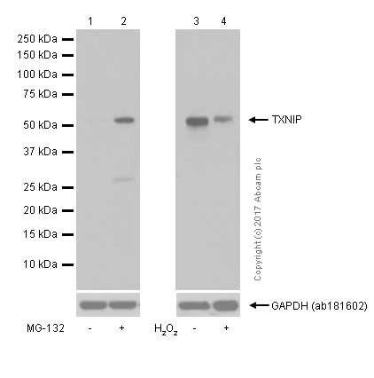 Western blot - Anti-TXNIP antibody [EPR14774] (AB188865)
