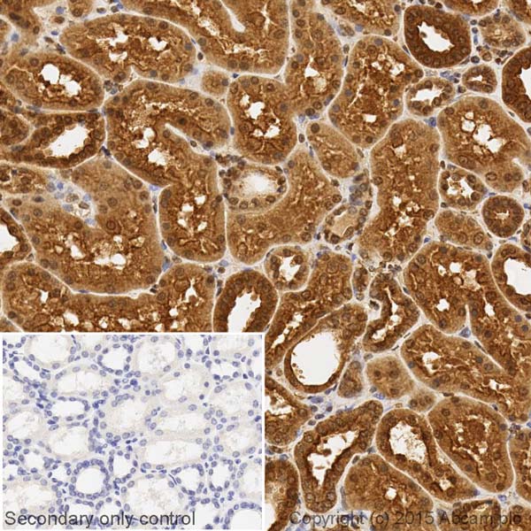 Immunohistochemistry (Formalin/PFA-fixed paraffin-embedded sections) - Anti-TXNIP antibody [EPR14774] - Mouse IgG2b (Chimeric) (AB210826), expandable thumbnail