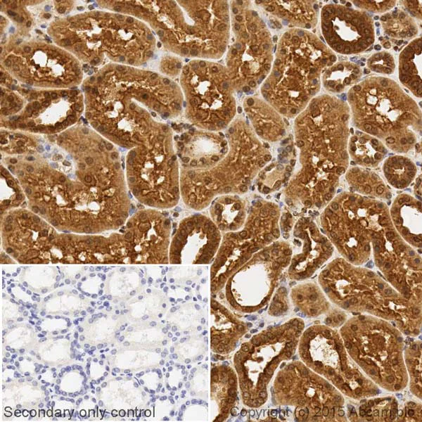 Immunohistochemistry (Formalin/PFA-fixed paraffin-embedded sections) - Anti-TXNIP antibody [EPR14774] - Mouse IgG2b (Chimeric) (AB210826)