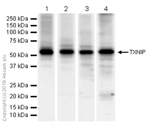 Western blot - Anti-TXNIP antibody [EPR14774] - Mouse IgG2b (Chimeric) - BSA and Azide free (AB232330)