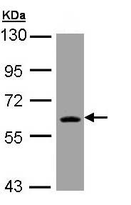 Western blot - Anti-TXNRD1 antibody (AB155790), expandable thumbnail