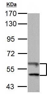 Western blot - Anti-TXNRD1 antibody (AB155790), expandable thumbnail