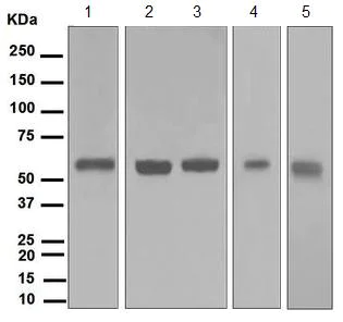 Western blot - Anti-TXNRD1 antibody [EPNCIR129] (AB124954)