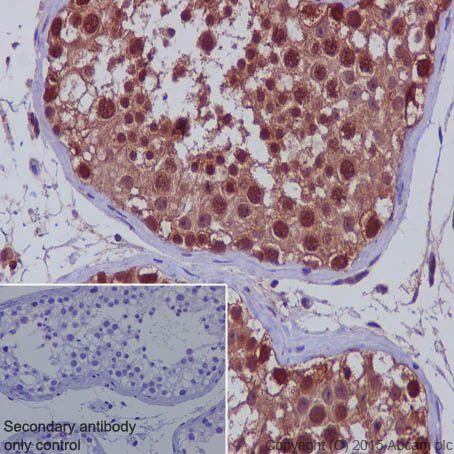 Immunohistochemistry (Formalin/PFA-fixed paraffin-embedded sections) - Anti-TXNRD1 antibody [EPNCIR129] - BSA and Azide free (AB187363)
