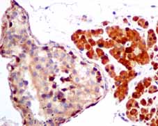 Immunohistochemistry (Formalin/PFA-fixed paraffin-embedded sections) - Anti-TXNRD1 antibody [EPR10204(B)] (AB151716), expandable thumbnail