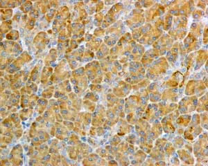 Immunohistochemistry (Formalin/PFA-fixed paraffin-embedded sections) - Anti-TXNRD1 antibody [EPR10205] (AB167411)