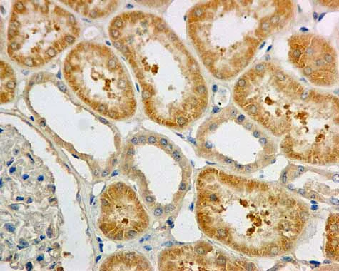Immunohistochemistry (Formalin/PFA-fixed paraffin-embedded sections) - Anti-TXNRD1 antibody [EPR10205] (AB167411)