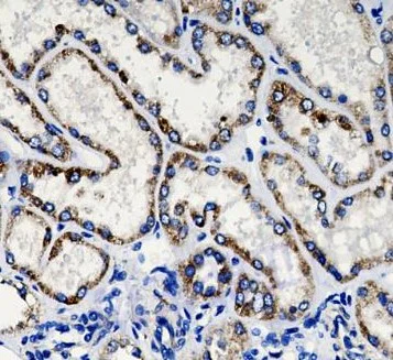 Immunohistochemistry (Formalin/PFA-fixed paraffin-embedded sections) - Anti-TXNRD2 antibody [SR4051] (AB326702)