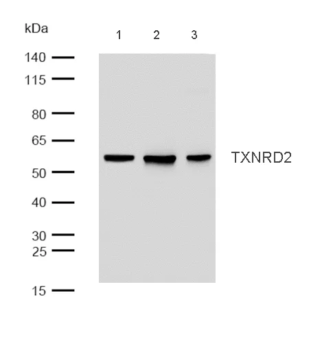 Western blot - Anti-TXNRD2 antibody [SR4051] (AB326702)