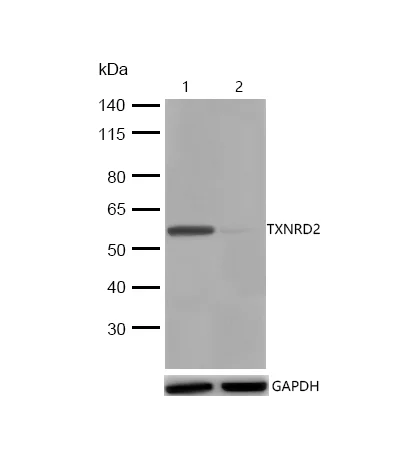 Western blot - Anti-TXNRD2 antibody [SR4051] (AB326702)
