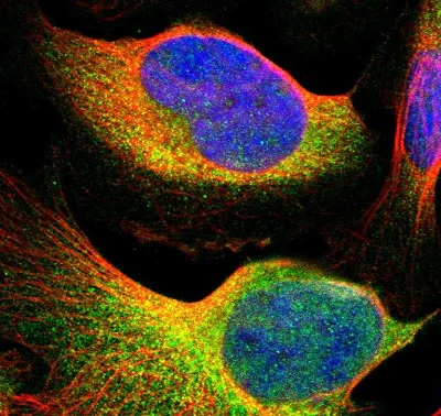 Immunocytochemistry/ Immunofluorescence - Anti-TYK2 antibody (AB223733)